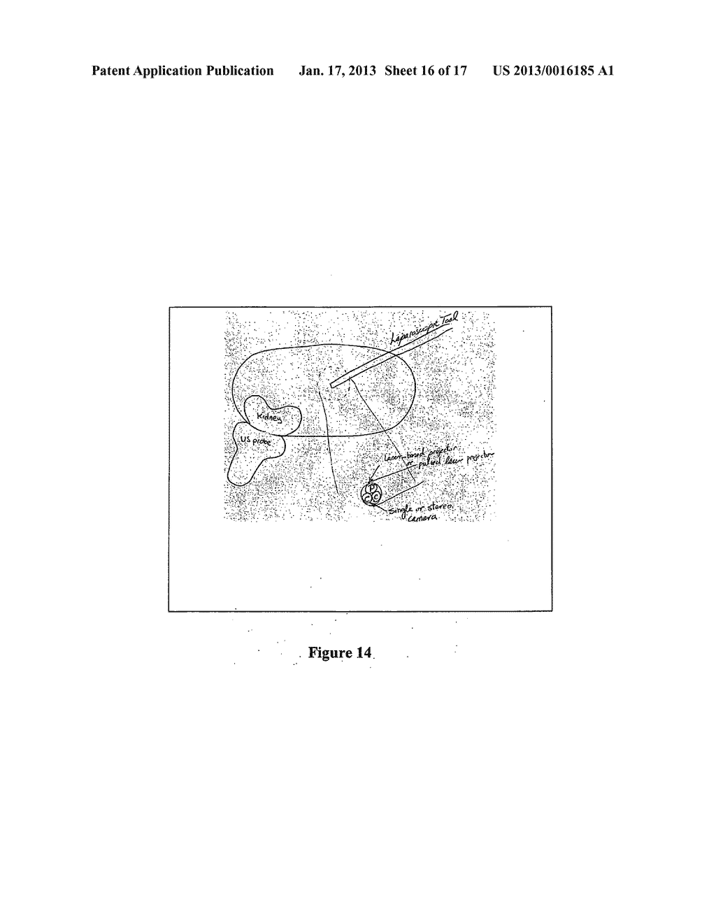 LOW-COST IMAGE-GUIDED NAVIGATION AND INTERVENTION SYSTEMS USING     COOPERATIVE SETS OF LOCAL SENSORS - diagram, schematic, and image 17