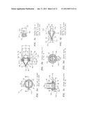 DIAPHRAGM PUMP USING DUCKBILL AND OTHER TYPES OF VALVESAANM VILLAGOMEZ; ManuelAACI CoronaAAST CAAACO USAAGP VILLAGOMEZ; Manuel Corona CA USAANM MEZA; Humberto V.AACI TustinAAST CAAACO USAAGP MEZA; Humberto V. Tustin CA USAANM PHILLIPS; David L.AACI Santa AnaAAST CAAACO USAAGP PHILLIPS; David L. Santa Ana CA US diagram and image