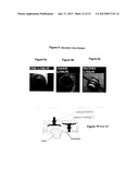 DIAPHRAGM PUMP USING DUCKBILL AND OTHER TYPES OF VALVESAANM VILLAGOMEZ; ManuelAACI CoronaAAST CAAACO USAAGP VILLAGOMEZ; Manuel Corona CA USAANM MEZA; Humberto V.AACI TustinAAST CAAACO USAAGP MEZA; Humberto V. Tustin CA USAANM PHILLIPS; David L.AACI Santa AnaAAST CAAACO USAAGP PHILLIPS; David L. Santa Ana CA US diagram and image