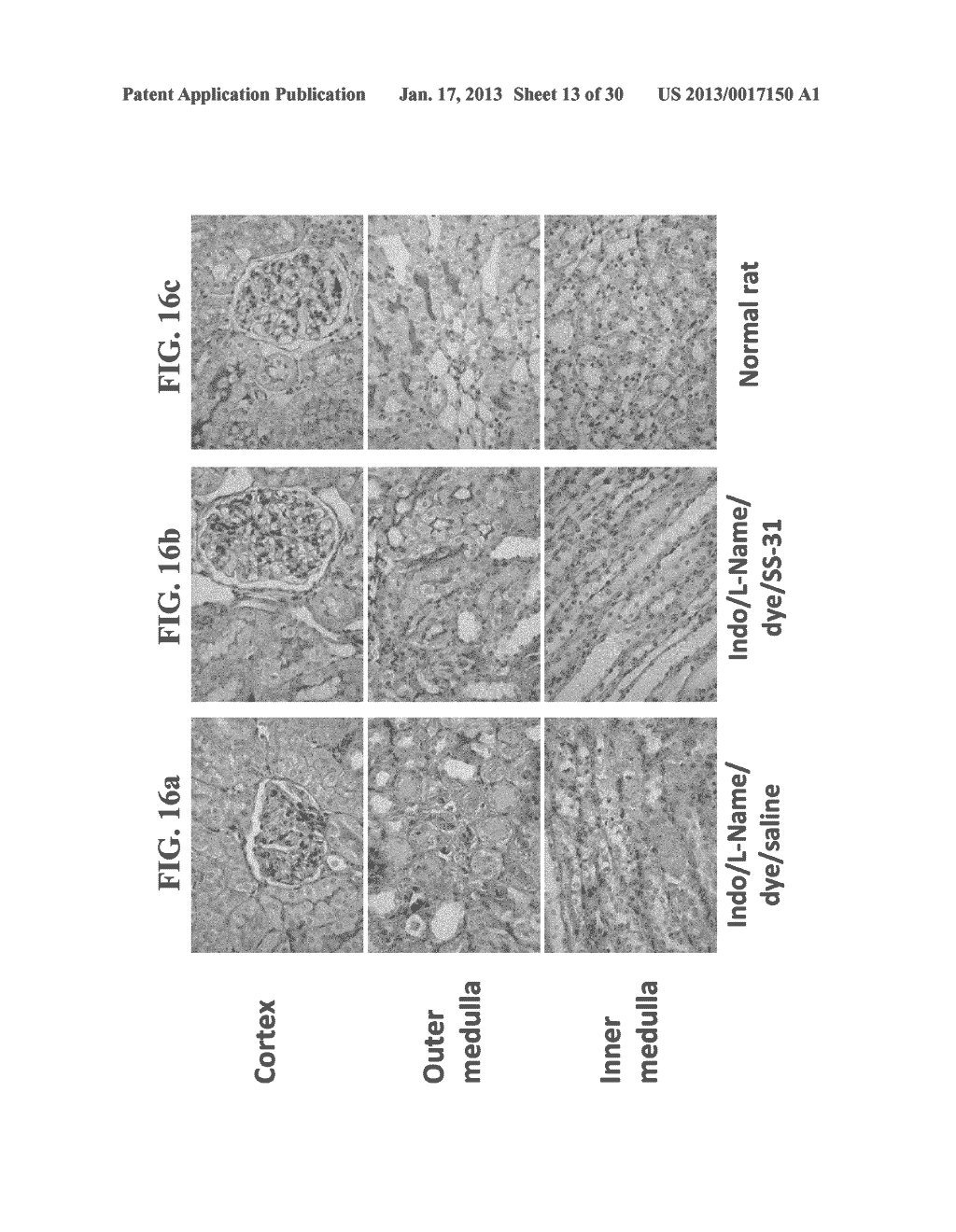 METHODS FOR PREVENTION AND TREATMENT OF ACUTE RENAL INJURY - diagram, schematic, and image 14