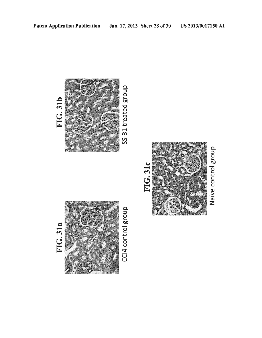 METHODS FOR PREVENTION AND TREATMENT OF ACUTE RENAL INJURY - diagram, schematic, and image 29