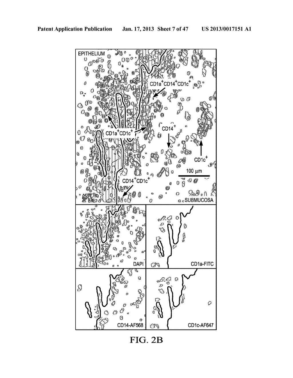 SUBSETS OF ANTIGEN-PRESENTING CELLS (APCs) IN THE HUMAN VAGINA AND THEIR     DISTINCT FUNCTIONS - diagram, schematic, and image 08