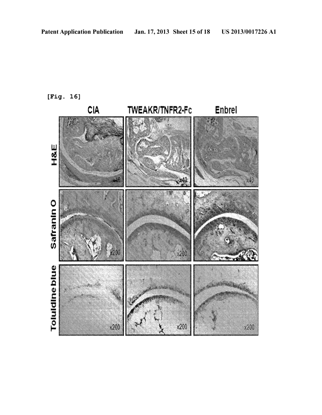 TNF-A and TWEAK Dual Antagonist for the Prophylaxis and Treatment of     Autoimmune DiseasesAANM Park; Young WooAACI DaejeonAACO KRAAGP Park; Young Woo Daejeon KRAANM Jo; Ki WonAACI Gyeonggi-doAACO KRAAGP Jo; Ki Won Gyeonggi-do KRAANM Yoo; Srok HoAACI DaejeonAACO KRAAGP Yoo; Srok Ho Daejeon KRAANM Yu; JungAACI DaejeonAACO KRAAGP Yu; Jung Daejeon KRAANM Kim; Dong JiAACI DaejeonAACO KRAAGP Kim; Dong Ji Daejeon KRAANM Yoon; Sun-HaAACI DaejeonAACO KRAAGP Yoon; Sun-Ha Daejeon KRAANM Song; Eun JungAACI DaejeonAACO KRAAGP Song; Eun Jung Daejeon KRAANM Lee; Eun KyungAACI Gyeonggi-doAACO KRAAGP Lee; Eun Kyung Gyeonggi-do KRAANM Oh; Jin MiAACI Gyeonggi-doAACO KRAAGP Oh; Jin Mi Gyeonggi-do KRAANM Cho; Kyu WonAACI SeoulAACO KRAAGP Cho; Kyu Won Seoul KRAANM Cho; Mi LaAACI SeoulAACO KRAAGP Cho; Mi La Seoul KRAANM Kim; Ho YounAACI SeoulAACO KRAAGP Kim; Ho Youn Seoul KRAANM Park; Mi KyungAACI Gyeonggi-doAACO KRAAGP Park; Mi Kyung Gyeonggi-do KRAANM Oh; Hye JwaAACI SeoulAACO KRAAGP Oh; Hye Jwa Seoul KRAANM Park; Jin SilAACI SeoulAACO KRAAGP Park; Jin Sil Seoul KRAANM Woo; Yun JuAACI SeoulAACO KRAAGP Woo; Yun Ju Seoul KRAANM Byun; Jae KyeongAACI Chungcheongbuk-doAACO KRAAGP Byun; Jae Kyeong Chungcheongbuk-do KRAANM Ryu; Jun GeolAACI Gangwon-doAACO KRAAGP Ryu; Jun Geol Gangwon-do KR - diagram, schematic, and image 16