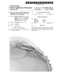 PROSTAGLANDIN AND PROSTAMIDE DRUG DELIVERY SYSTEMS AND INTRAOCULAR     THERAPEUTIC USES THEREOF diagram and image