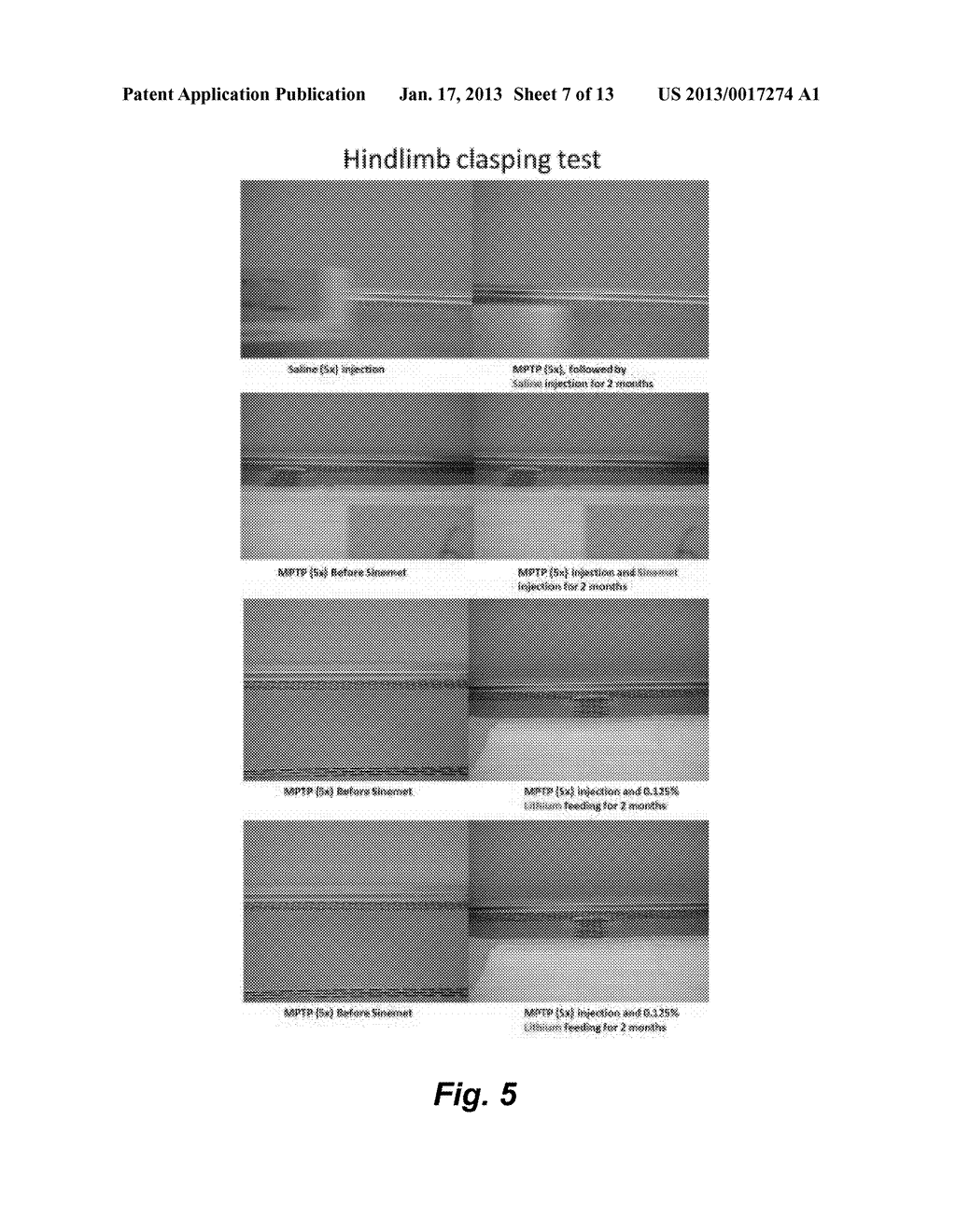 LOW DOSE LITHIUM IN THE TREATMENT OR PROPHYLAXIS OF PARKINSON'S DISEASE - diagram, schematic, and image 08