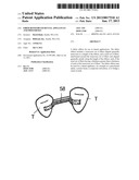 FIBER REINFORCED DENTAL APPLIANCES AND PROSTHESES diagram and image