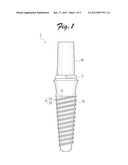 IMPLANT FIXTUREAANM Kashiwabara; TatekiAACI Kakamigahara-shiAACO JPAAGP Kashiwabara; Tateki Kakamigahara-shi JPAANM Goto; TetsuroAACI Kakamigahara-shiAACO JPAAGP Goto; Tetsuro Kakamigahara-shi JPAANM Deguchi; MikitoAACI Kyoto-shiAACO JPAAGP Deguchi; Mikito Kyoto-shi JPAANM Yoshimoto; RyuichiAACI Kyoto-shiAACO JPAAGP Yoshimoto; Ryuichi Kyoto-shi JPAANM Hori; KojiAACI Kyoto-shiAACO JPAAGP Hori; Koji Kyoto-shi JPAANM Ito; MichioAACI NaganoAACO JPAAGP Ito; Michio Nagano JP diagram and image