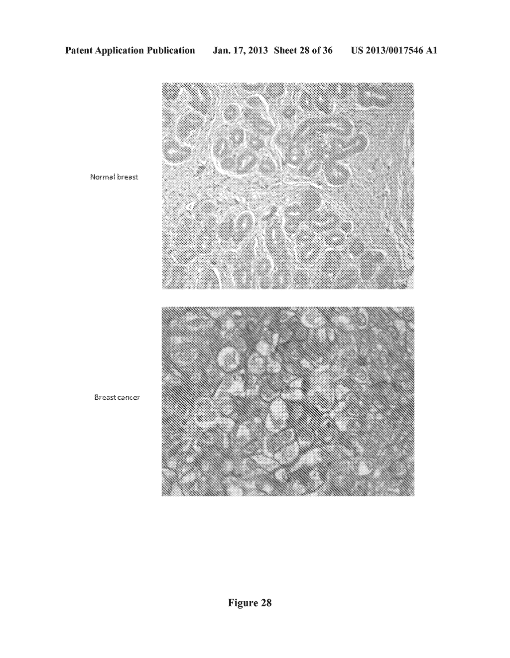 Breast Tumor Markers and Methods of Use ThereofAANM Grifantini; RenataAACI SienaAACO ITAAGP Grifantini; Renata Siena ITAANM Pileri; PieroAACI SienaAACO ITAAGP Pileri; Piero Siena ITAANM Campagnoli; SusannaAACI SienaAACO ITAAGP Campagnoli; Susanna Siena ITAANM Grandi; AlbertoAACI SienaAACO ITAAGP Grandi; Alberto Siena ITAANM Parri; MatteoAACI SienaAACO ITAAGP Parri; Matteo Siena ITAANM Pierleoni; AndreaAACI SienaAACO ITAAGP Pierleoni; Andrea Siena ITAANM Nogarotto; RenzoAACI SienaAACO ITAAGP Nogarotto; Renzo Siena IT - diagram, schematic, and image 29