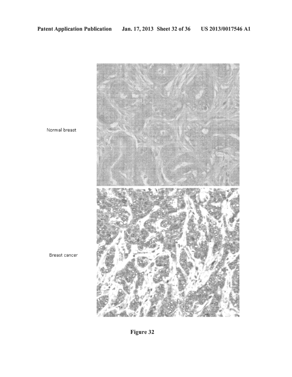 Breast Tumor Markers and Methods of Use ThereofAANM Grifantini; RenataAACI SienaAACO ITAAGP Grifantini; Renata Siena ITAANM Pileri; PieroAACI SienaAACO ITAAGP Pileri; Piero Siena ITAANM Campagnoli; SusannaAACI SienaAACO ITAAGP Campagnoli; Susanna Siena ITAANM Grandi; AlbertoAACI SienaAACO ITAAGP Grandi; Alberto Siena ITAANM Parri; MatteoAACI SienaAACO ITAAGP Parri; Matteo Siena ITAANM Pierleoni; AndreaAACI SienaAACO ITAAGP Pierleoni; Andrea Siena ITAANM Nogarotto; RenzoAACI SienaAACO ITAAGP Nogarotto; Renzo Siena IT - diagram, schematic, and image 33