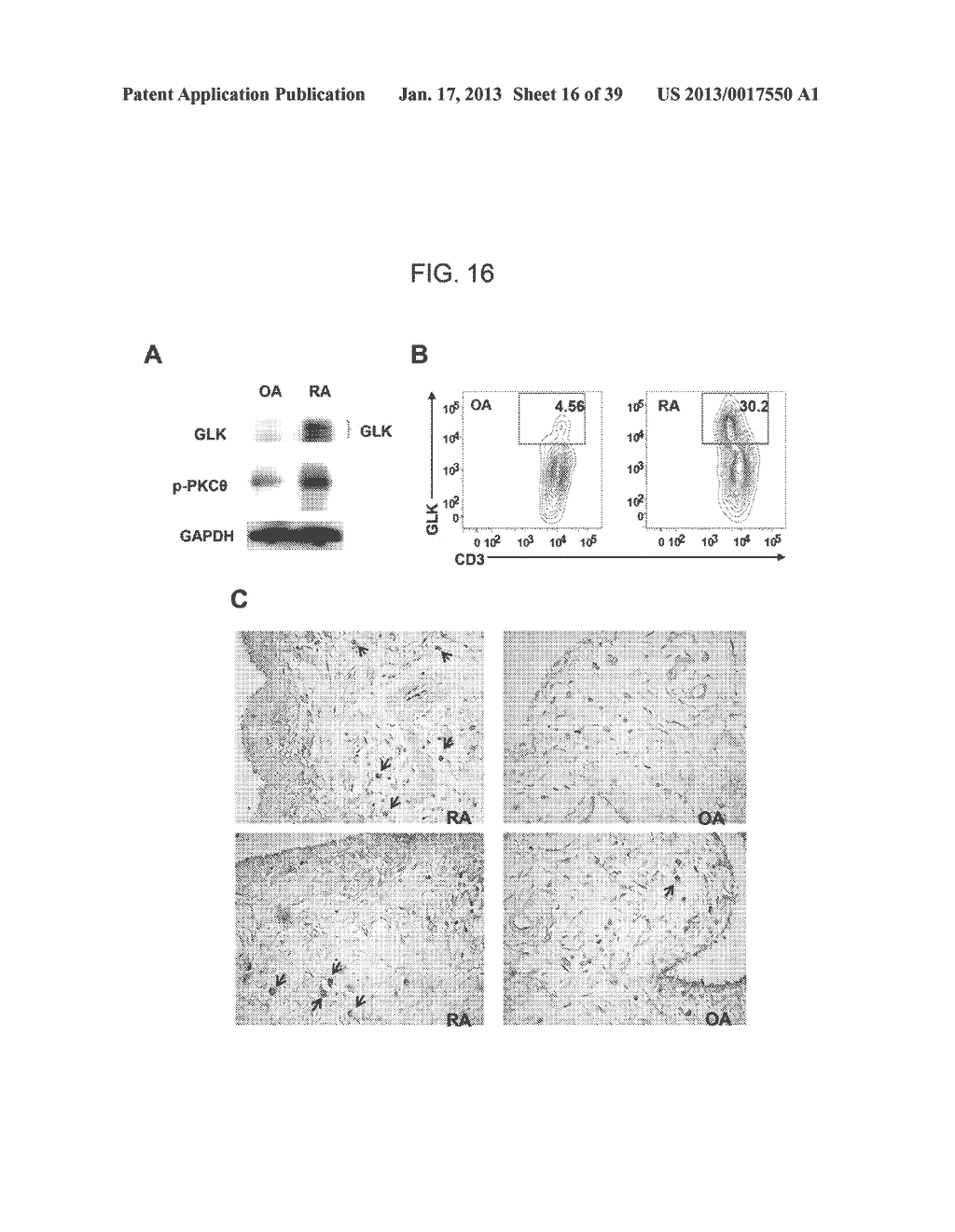 MAP KINASE KINASE KINASE KINASE 3 (MAP4K3) AS A BIOMARKER AND THERAPETIC     TARGET FOR AUTOIMMUNE DISEASE, CANCER, INFLAMMATION AND IL-17-ASSOCIATED     DISEASE - diagram, schematic, and image 17