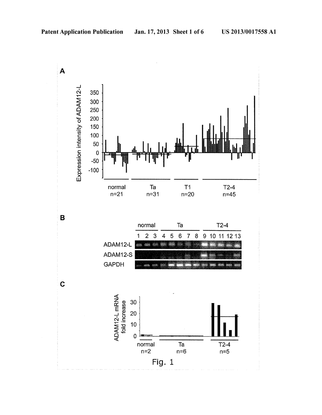 ADAM12 AS A BIOMARKER FOR BLADDER CANCER - diagram, schematic, and image 02