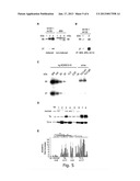 ADAM12 AS A BIOMARKER FOR BLADDER CANCER diagram and image