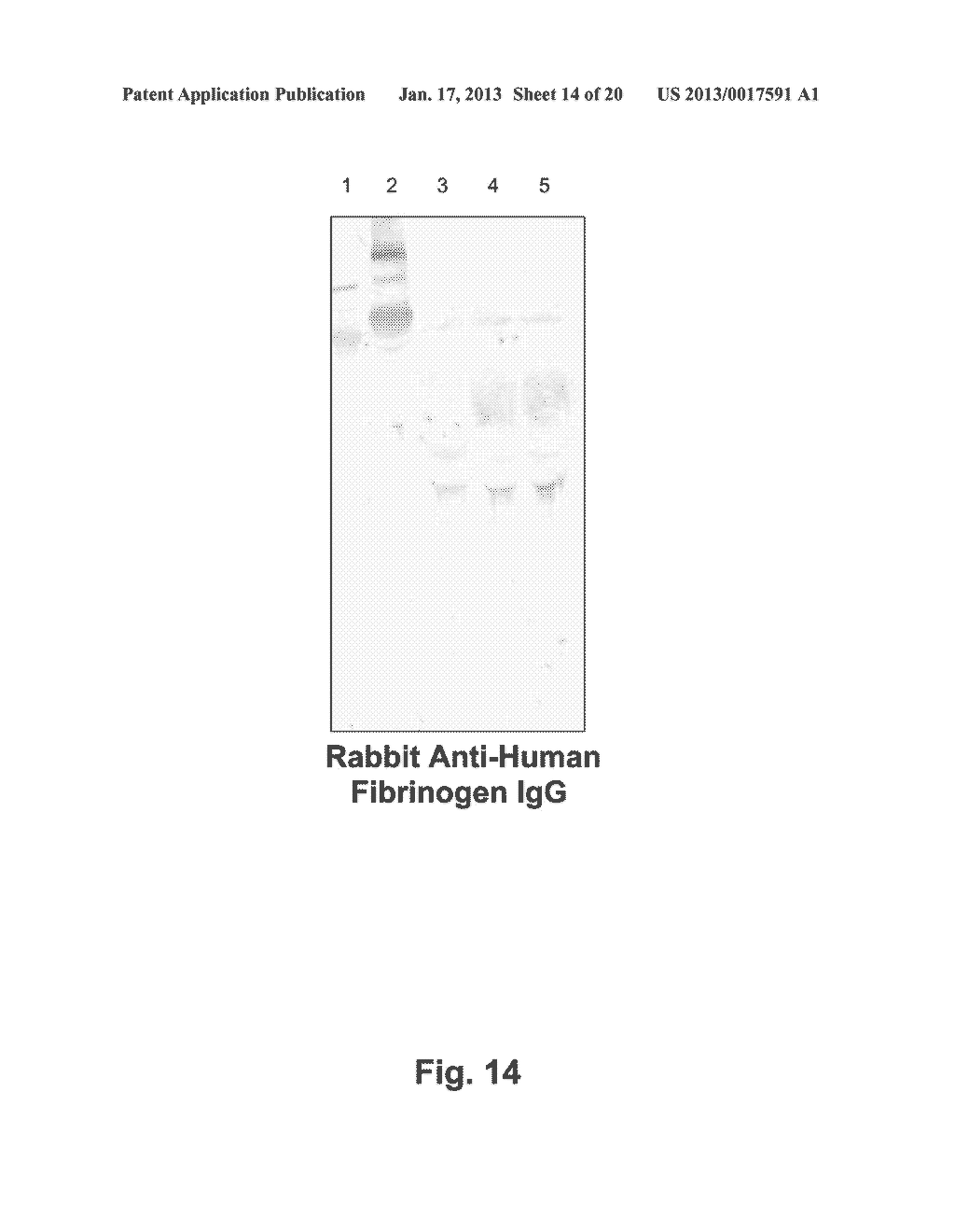 Method for the Preparation of Recombinant Human Thrombin and Fibrinogen - diagram, schematic, and image 15