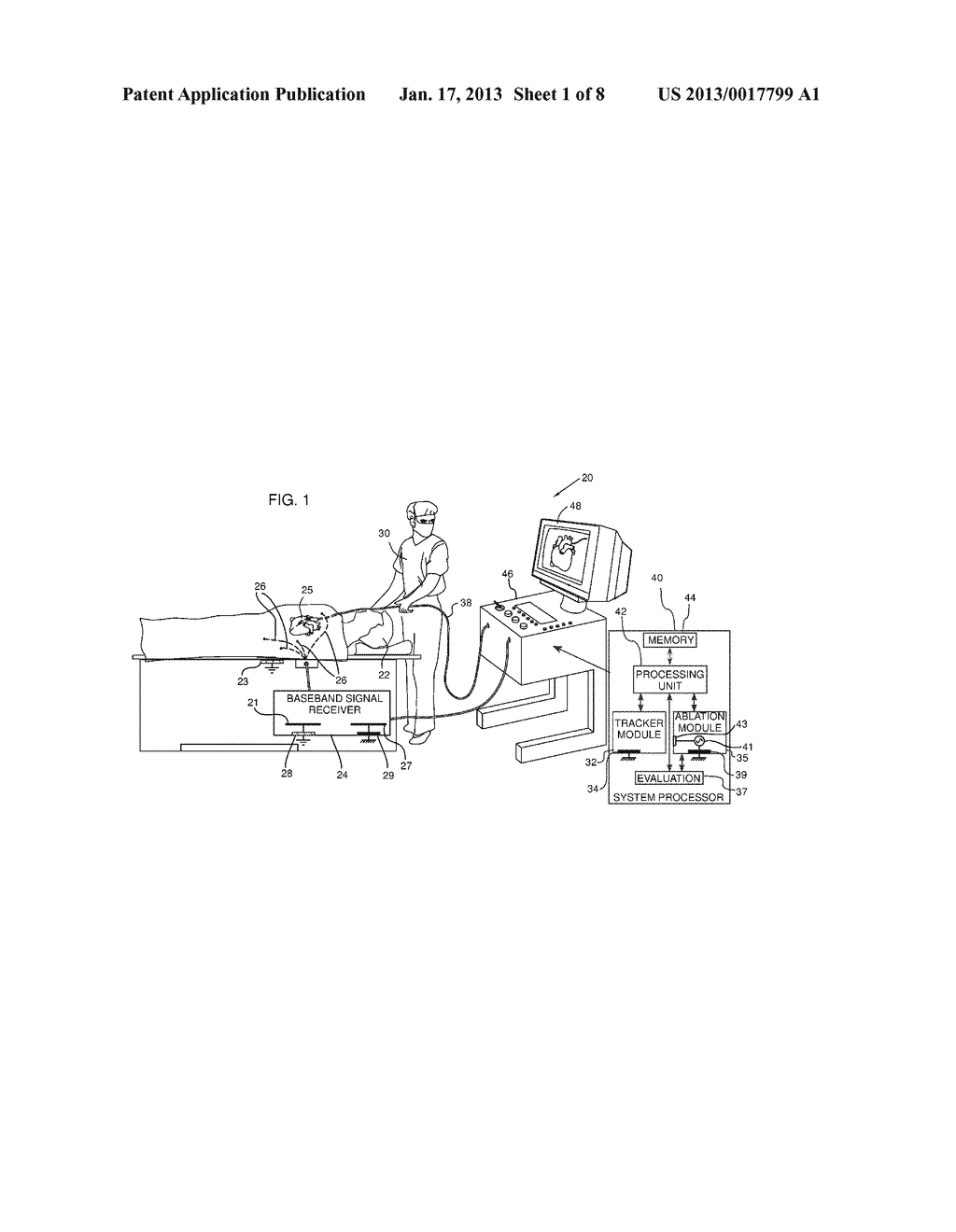 PATIENT LEAKAGE CURRENT LIMITATIONAANM Feldchtein; MikhaelAACI Qiriat YamAACO ILAAGP Feldchtein; Mikhael Qiriat Yam IL - diagram, schematic, and image 02