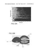 GOLF CLUB HEADS WITH IMPROVED SOUND CHARACTERISTICS diagram and image