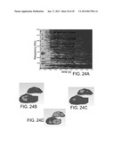 GOLF CLUB HEADS WITH IMPROVED SOUND CHARACTERISTICS diagram and image