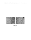 COMPOSITIONS AND METHODS FOR TREATING AIDS OR CANCER BY INHIBITING THE     SECRETION OF MICROPARTICLES diagram and image