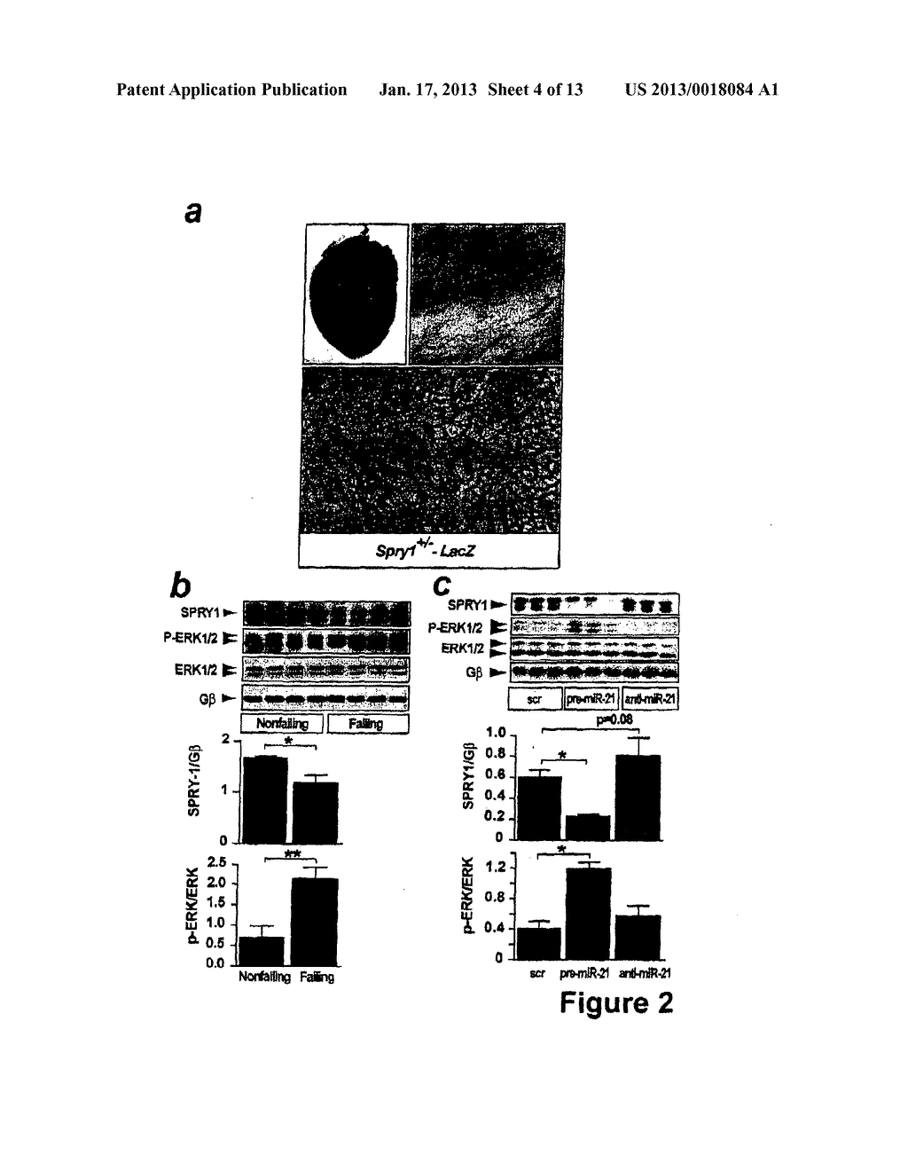 MICRORNA (miRNA) AND DOWNSTREAM TARGETS FOR DIAGNOSTIC AND THERAPEUTIC     PURPOSES - diagram, schematic, and image 05