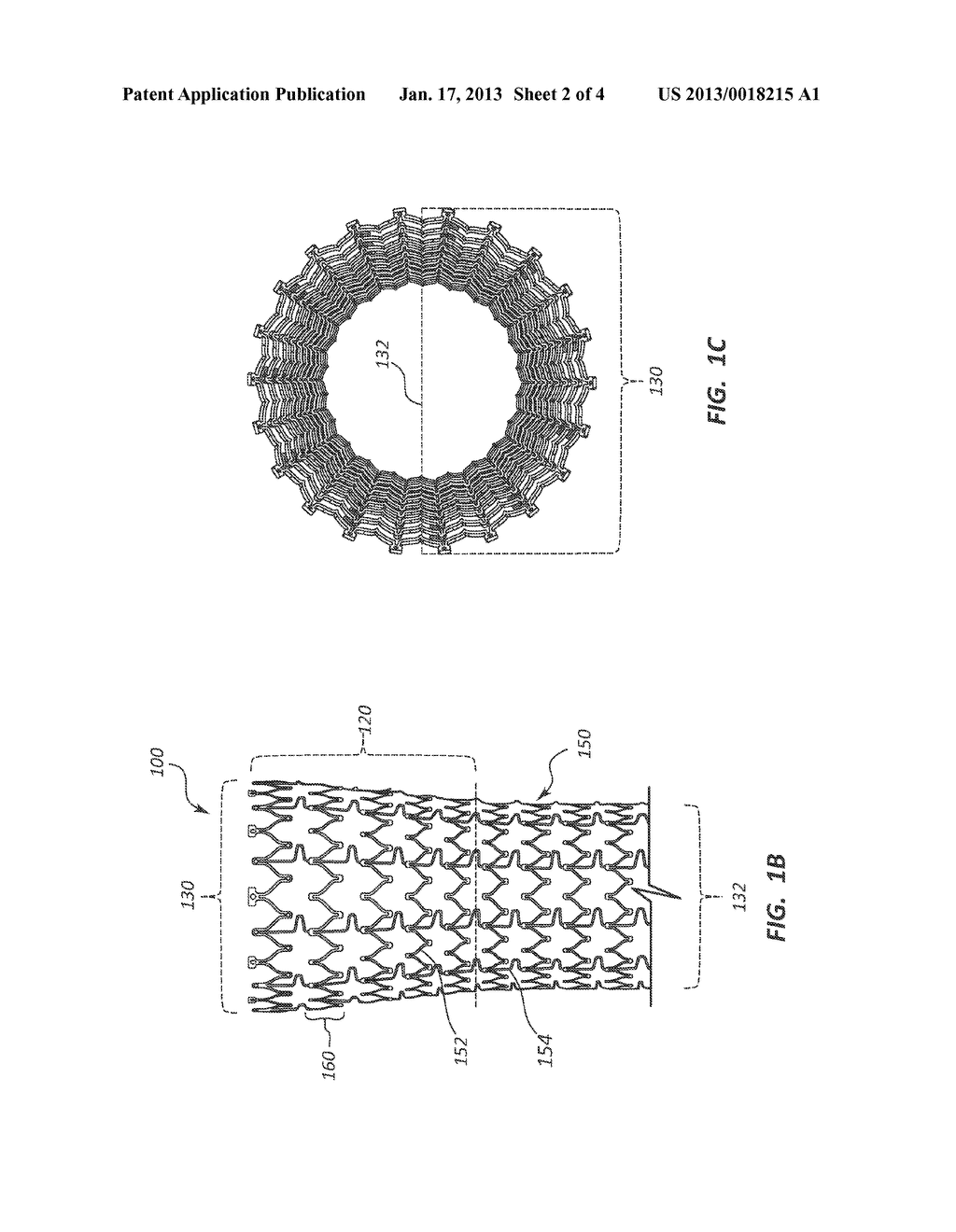 ESOPHAGEAL STENT AND METHODS FOR USE OF SAME - diagram, schematic, and image 03