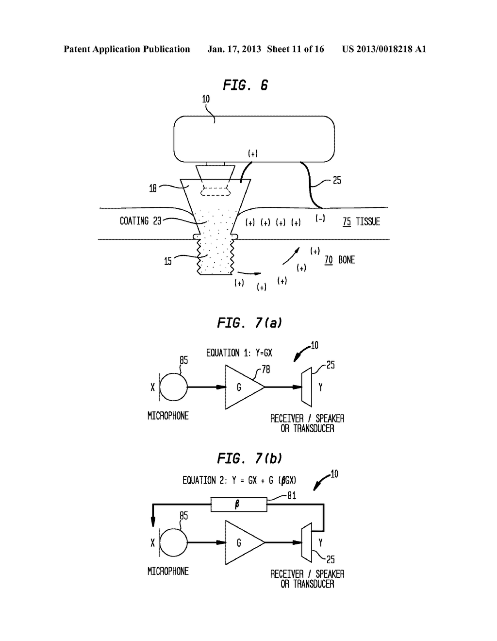 Systems, Devices, Components and Methods for Bone Conduction Hearing Aids - diagram, schematic, and image 12