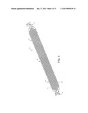 Implant Systems with Tensioning Feedback diagram and image