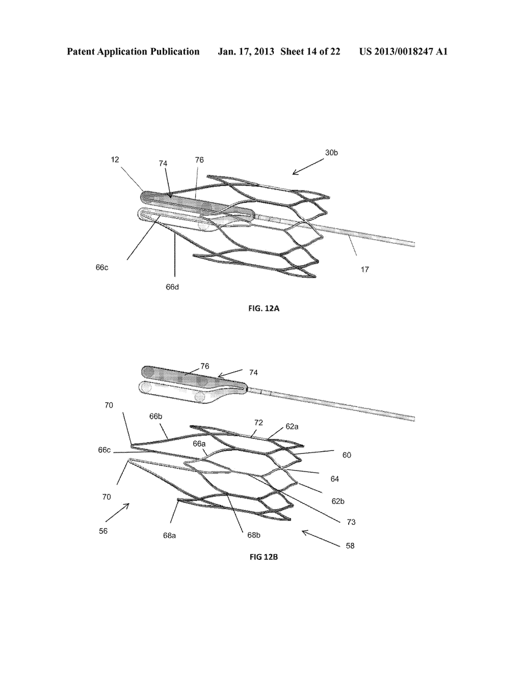 INTRAVASCULAR ELECTRODES AND ANCHORING DEVICES FOR TRANSVASCULAR     STIMULATION - diagram, schematic, and image 15