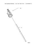 INTRAVASCULAR ELECTRODES AND ANCHORING DEVICES FOR TRANSVASCULAR     STIMULATION diagram and image