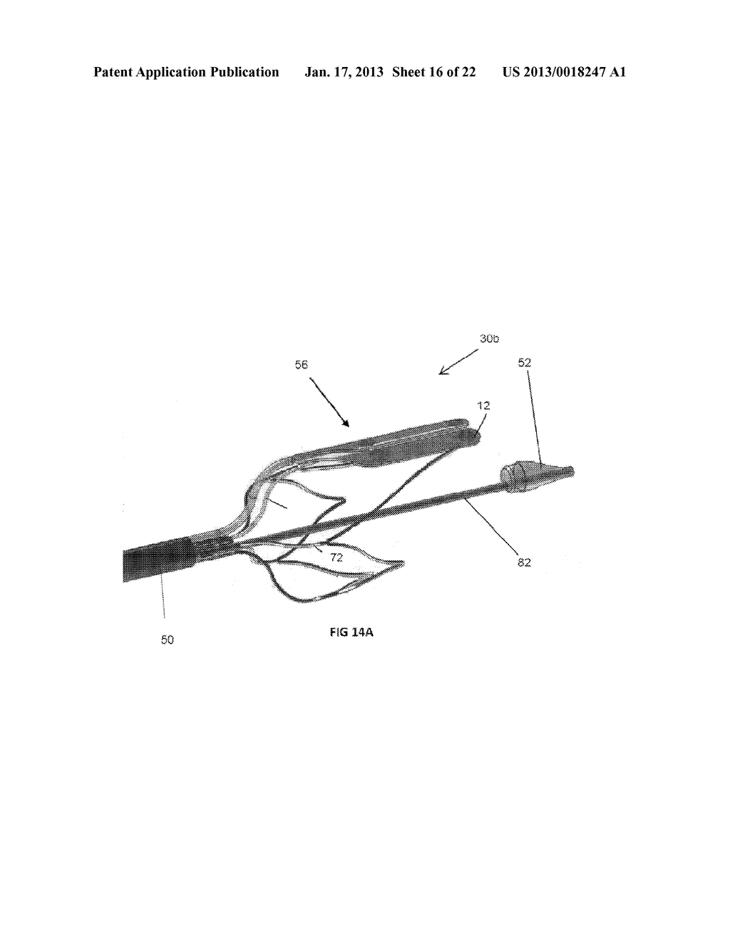 INTRAVASCULAR ELECTRODES AND ANCHORING DEVICES FOR TRANSVASCULAR     STIMULATION - diagram, schematic, and image 17