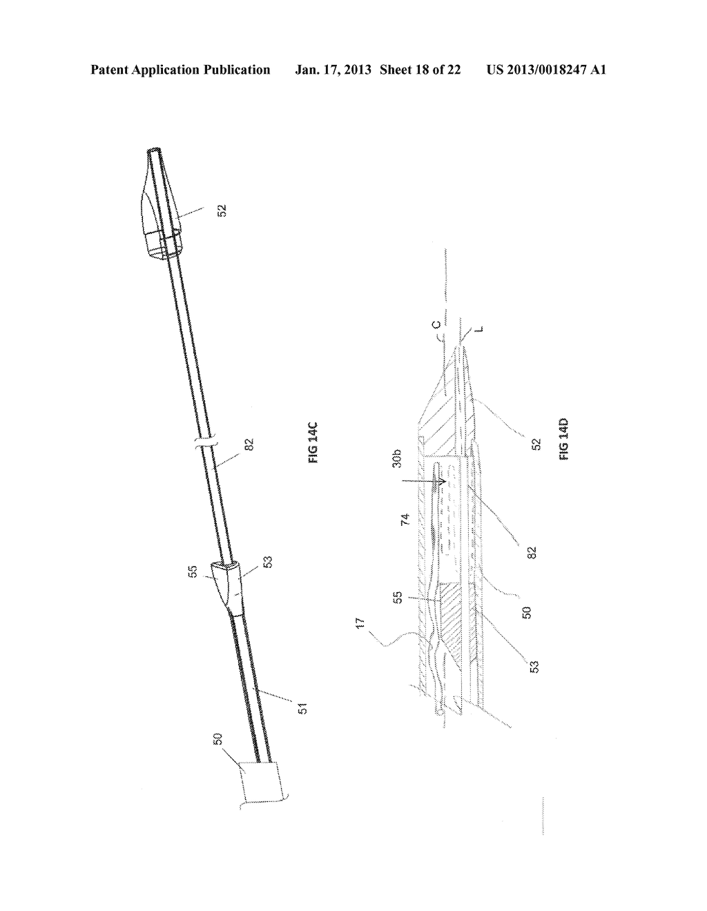 INTRAVASCULAR ELECTRODES AND ANCHORING DEVICES FOR TRANSVASCULAR     STIMULATION - diagram, schematic, and image 19