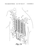 RELEASABLE LINER FOR SENSOR DEVICEAANM Caprio; MatthewAACI SeattleAAST WAAACO USAAGP Caprio; Matthew Seattle WA USAANM Clay; AndrewAACI EverettAAST WAAACO USAAGP Clay; Andrew Everett WA USAANM Ladwig; Jeffrey WilliamAACI SeattleAAST WAAACO USAAGP Ladwig; Jeffrey William Seattle WA US diagram and image