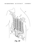 RELEASABLE LINER FOR SENSOR DEVICEAANM Caprio; MatthewAACI SeattleAAST WAAACO USAAGP Caprio; Matthew Seattle WA USAANM Clay; AndrewAACI EverettAAST WAAACO USAAGP Clay; Andrew Everett WA USAANM Ladwig; Jeffrey WilliamAACI SeattleAAST WAAACO USAAGP Ladwig; Jeffrey William Seattle WA US diagram and image