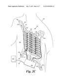 RELEASABLE LINER FOR SENSOR DEVICEAANM Caprio; MatthewAACI SeattleAAST WAAACO USAAGP Caprio; Matthew Seattle WA USAANM Clay; AndrewAACI EverettAAST WAAACO USAAGP Clay; Andrew Everett WA USAANM Ladwig; Jeffrey WilliamAACI SeattleAAST WAAACO USAAGP Ladwig; Jeffrey William Seattle WA US diagram and image