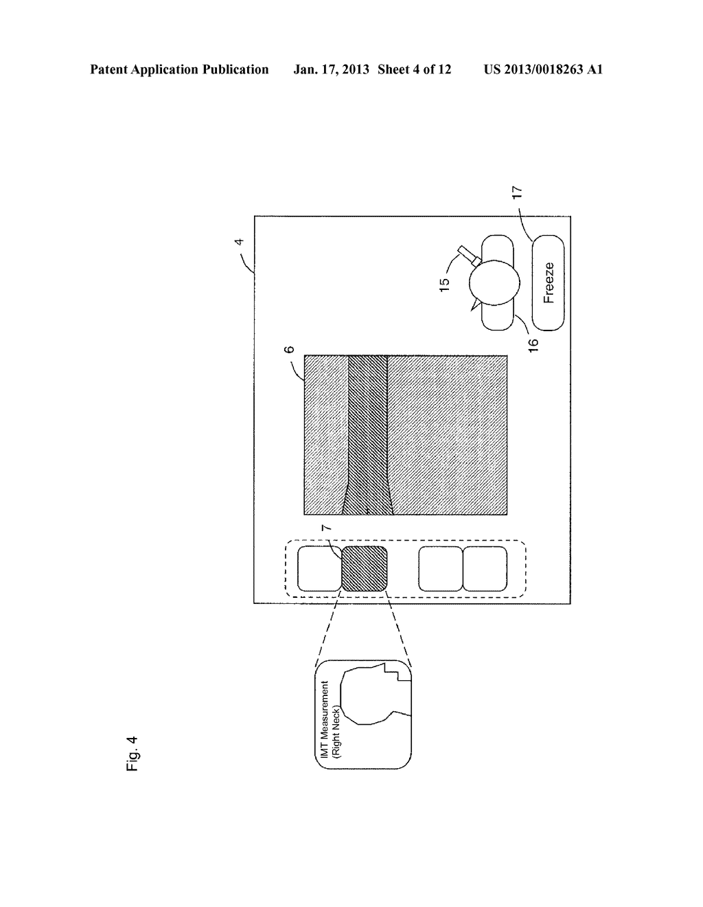 ULTRASOUND DIAGNOSTIC APPARATUS AND ULTRASOUND DIAGNOSTIC SYSTEMAANM Kimoto; TakashiAACI KanagawaAACO JPAAGP Kimoto; Takashi Kanagawa JPAANM Satake; KatsumiAACI KanagawaAACO JPAAGP Satake; Katsumi Kanagawa JPAANM Fukai; SeiichiAACI KanagawaAACO JPAAGP Fukai; Seiichi Kanagawa JPAANM Uchikawa; SatoruAACI TokyoAACO JPAAGP Uchikawa; Satoru Tokyo JPAANM Hirasawa; HajimeAACI KanagawaAACO JPAAGP Hirasawa; Hajime Kanagawa JPAANM Kimura; MasaoAACI KanagawaAACO JPAAGP Kimura; Masao Kanagawa JP - diagram, schematic, and image 05