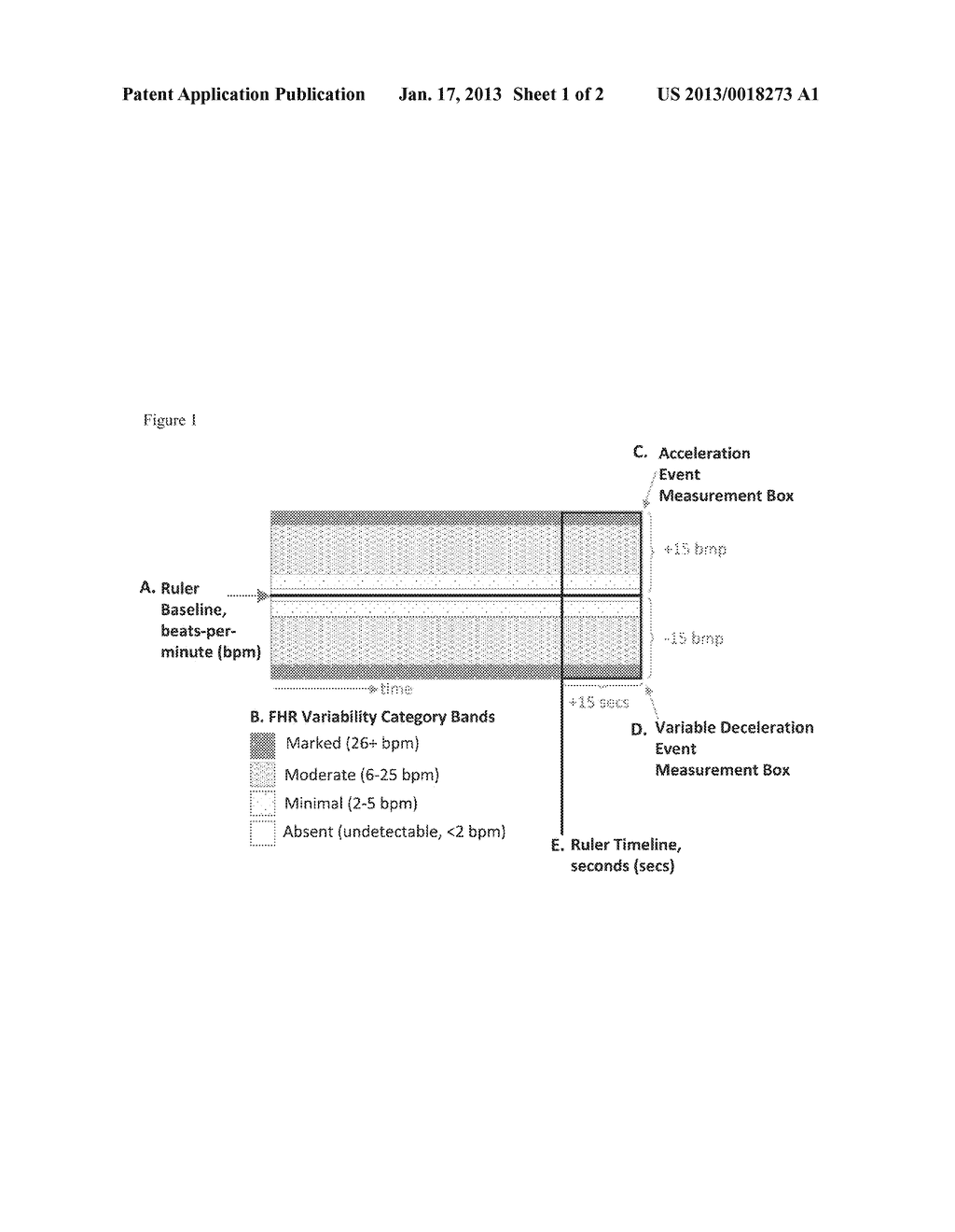 SYSTEMS AND METHODS FOR ANALYSIS OF FETAL HEART RATE DATA - diagram, schematic, and image 02