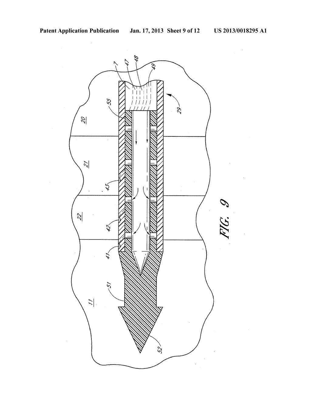 OCULAR IMPLANT WITH ANCHORING MECHANISM AND MULTIPLE OUTLETS - diagram, schematic, and image 10