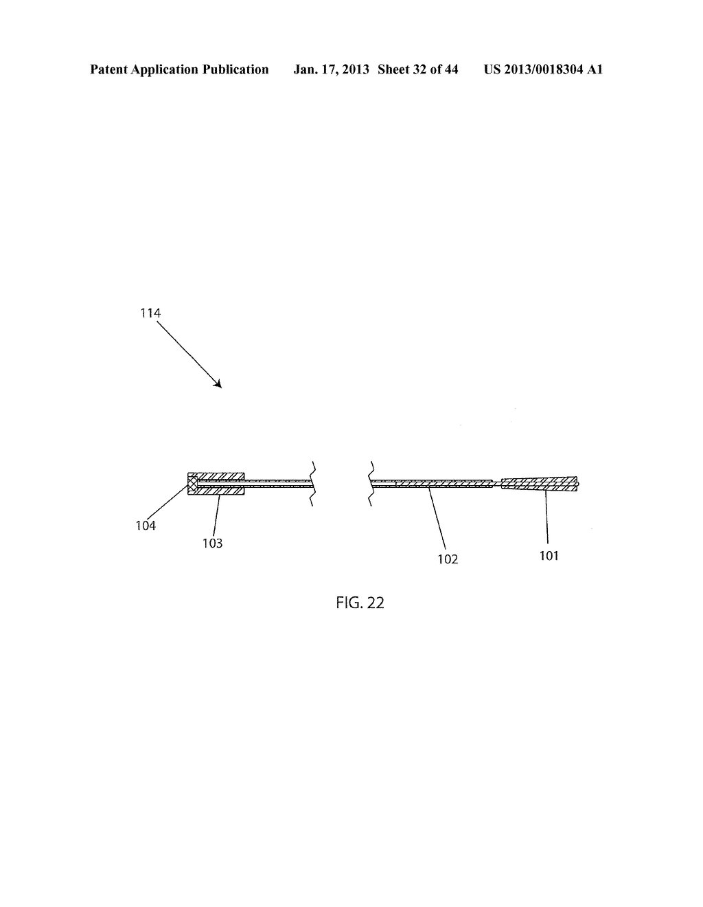 DEVICES FOR CLEARING BLOCKAGES IN IN-SITU ARTIFICIAL LUMENS - diagram, schematic, and image 33