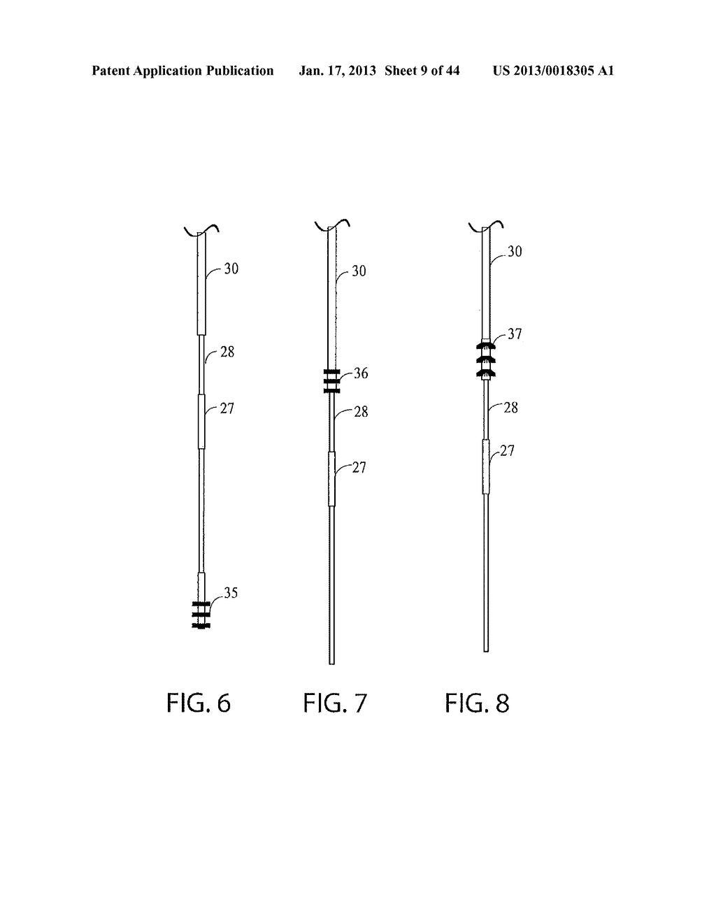 DEVICES FOR CLEARING BLOCKAGES IN IN-SITU ARTIFICIAL LUMENS - diagram, schematic, and image 10