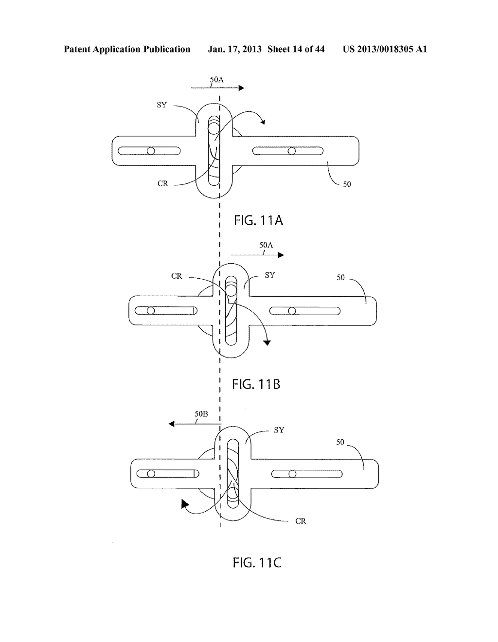 DEVICES FOR CLEARING BLOCKAGES IN IN-SITU ARTIFICIAL LUMENS - diagram, schematic, and image 15