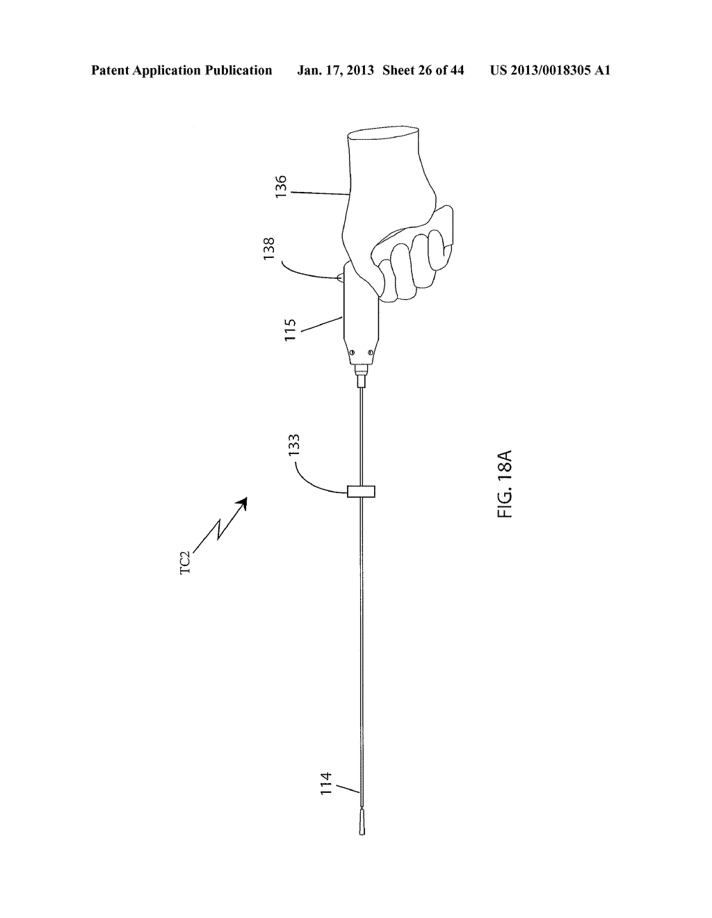 DEVICES FOR CLEARING BLOCKAGES IN IN-SITU ARTIFICIAL LUMENS - diagram, schematic, and image 27