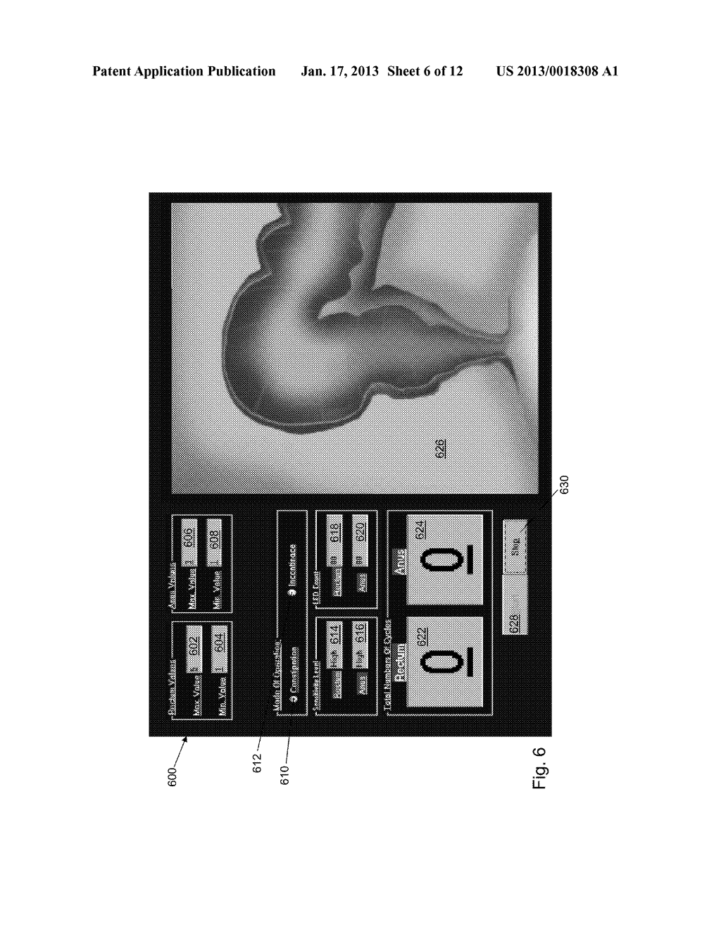 BIOFEEDBACK TRAINING OF ANAL AND RECTAL MUSCLES - diagram, schematic, and image 07