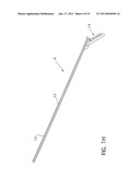 TEAR-AWAY SHEATH WITH INTEGRAL STOP diagram and image