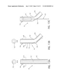 TEAR-AWAY SHEATH WITH INTEGRAL STOP diagram and image