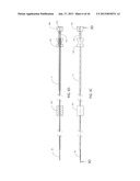 DEVICES FOR CLEARING BLOCKAGES IN IN-SITU ARTIFICIAL LUMENS diagram and image