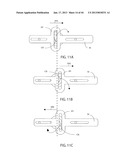 DEVICES FOR CLEARING BLOCKAGES IN IN-SITU ARTIFICIAL LUMENS diagram and image