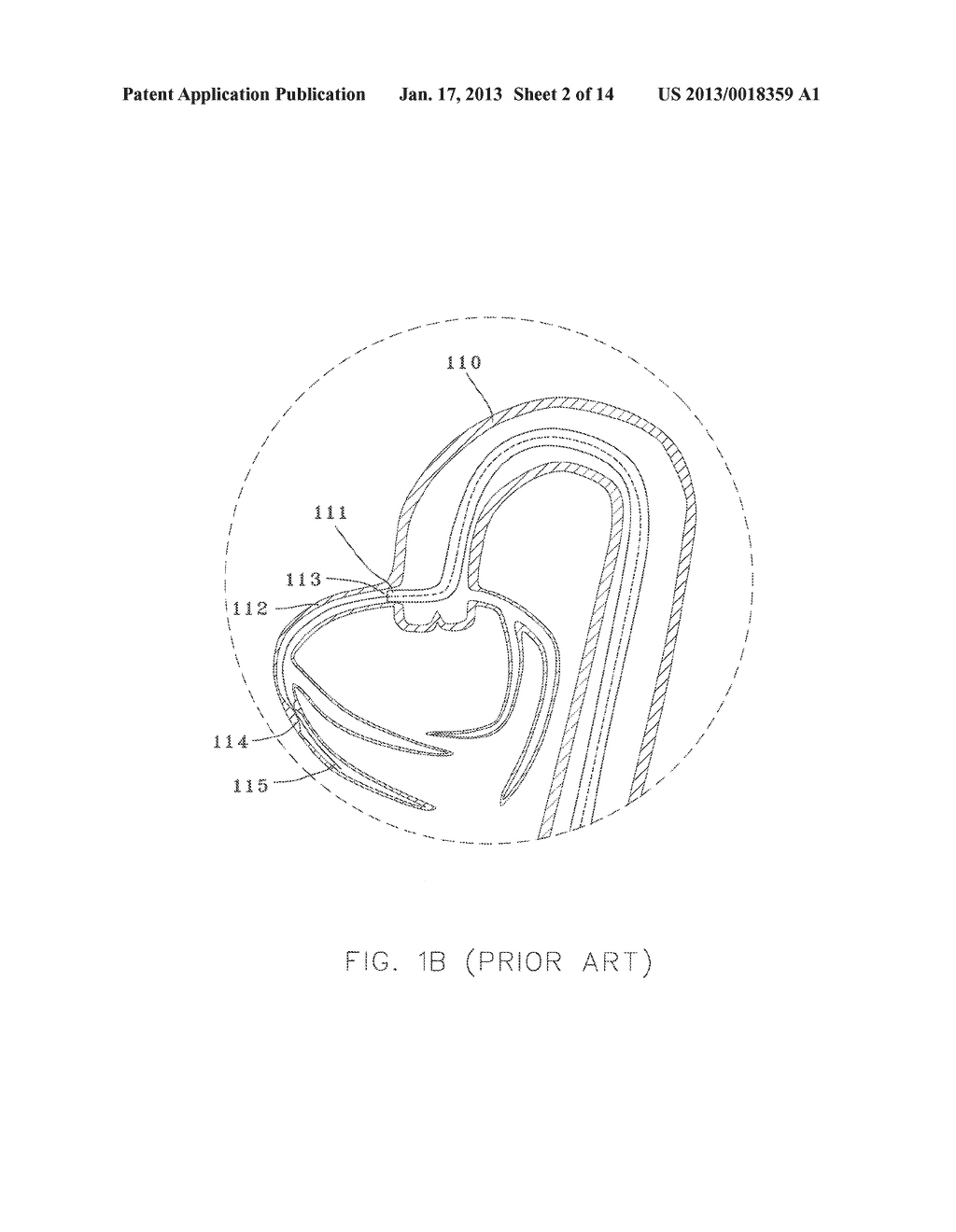 Guide Wire Incorporating a HandleAANM Coyle; James A.AACI Co RoscommonAACO IEAAGP Coyle; James A. Co Roscommon IE - diagram, schematic, and image 03