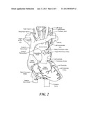 SYSTEMS AND METHODS FOR TREATMENT IN PROXIMITY TO SENSITIVE TISSUE     STRUCTURESAANM MIHALIK; Teresa AnnAACI EncinitasAAST CAAACO USAAGP MIHALIK; Teresa Ann Encinitas CA US diagram and image