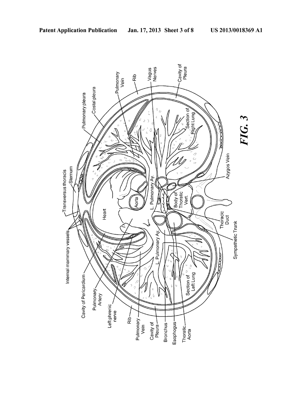 SYSTEMS AND METHODS FOR TREATMENT IN PROXIMITY TO SENSITIVE TISSUE     STRUCTURESAANM MIHALIK; Teresa AnnAACI EncinitasAAST CAAACO USAAGP MIHALIK; Teresa Ann Encinitas CA US - diagram, schematic, and image 04