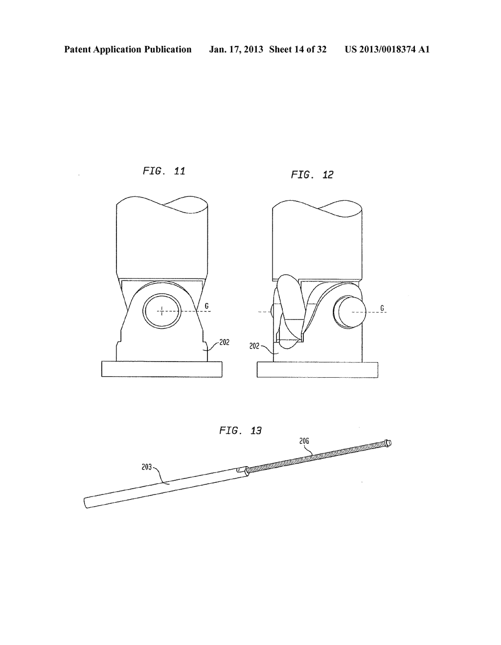 EXTERNAL FIXATION SYSTEM - diagram, schematic, and image 15