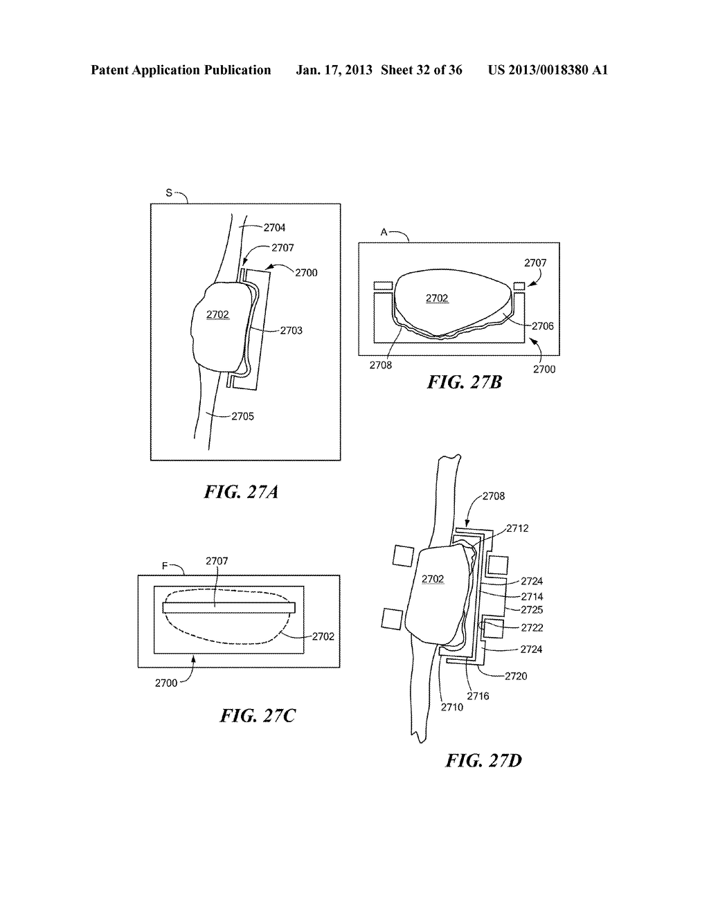 JOINT ARTHROPLASTY DEVICES AND SURGICAL TOOLS - diagram, schematic, and image 33