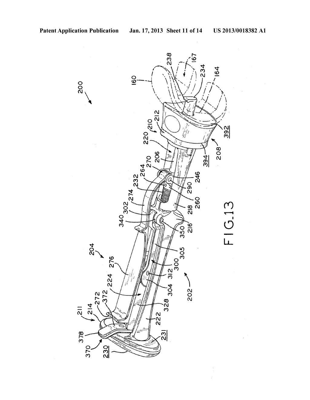 FEMORAL COMPONENT INSTRUMENTAANM Jones; Nolan C.AACI WarsawAAST INAACO USAAGP Jones; Nolan C. Warsaw IN USAANM VanDiepenbos; Jeffery A.AACI SyracuseAAST INAACO USAAGP VanDiepenbos; Jeffery A. Syracuse IN US - diagram, schematic, and image 12